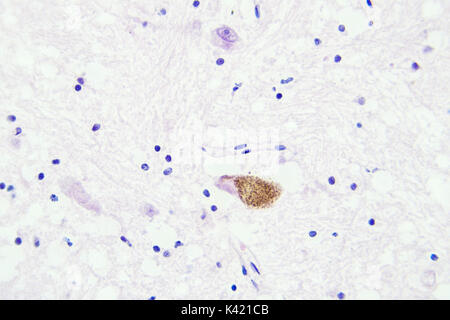 Les tissus du cerveau vue microscopique agrandissement x400 Banque D'Images