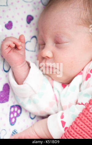 Petit Bebe Avec Une Tache Rouge Sur L Arriere De Sa Tete Photo Stock Alamy