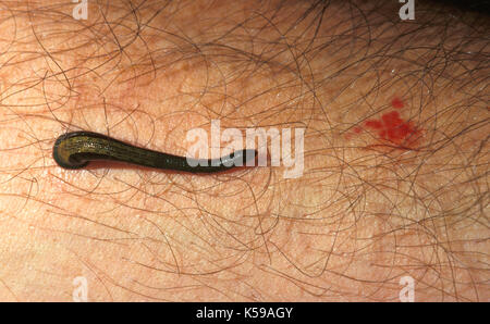 Tiger Leech, haemadipsa picta, dannum vallée, Sabah, Bornéo, mordre sang chair Banque D'Images