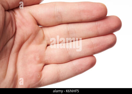 Côté palm avec blister close up isolé sur fond blanc Banque D'Images