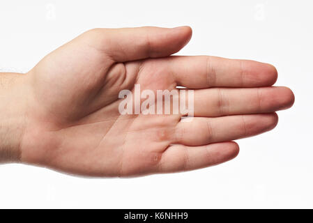 Main de jeune femme avec les callosités isolé sur fond blanc Banque D'Images