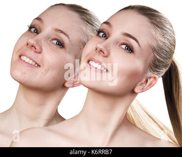 Portrait de jeune femme avant et après la retouche sur fond blanc. Banque D'Images