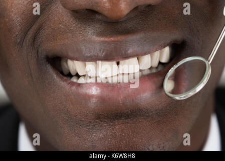 Close-up of médecin mains faisant le dentiste d'homme patient africain Banque D'Images