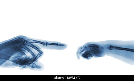 X-ray mains adultes pointer du doigt le côté gauche et de la main de bébé à droite. zone vide au côté supérieur . Banque D'Images