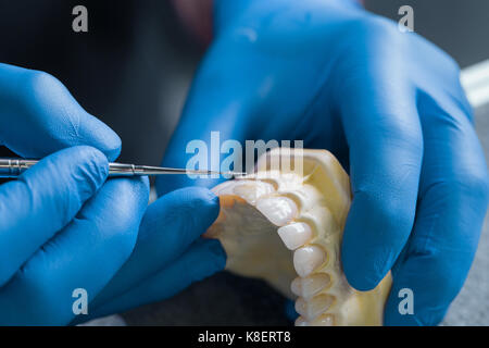 Main tenant des modèles de gypse dentaire mâchoire supérieure, concept dentaire. Rabat Banque D'Images