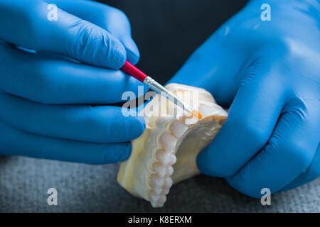 Main tenant le gypse dentaire soins dentaires, les modèles de concept. Tassel Banque D'Images