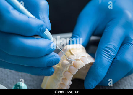 Main tenant des modèles de gypse dentaire mâchoire supérieure, concept dentaire. Rabat Banque D'Images