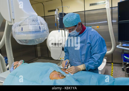 L'ablation par radiofréquence Banque D'Images