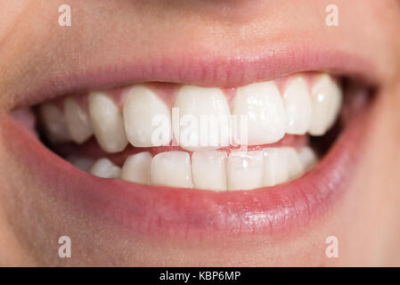 Gros plan du jeune femme montrant des dents blanches Banque D'Images