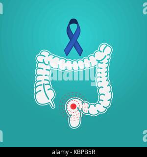 Le cancer du côlon icône logo vector illustration Illustration de Vecteur