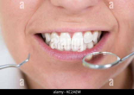 Close-up of a woman examining ses dents Banque D'Images