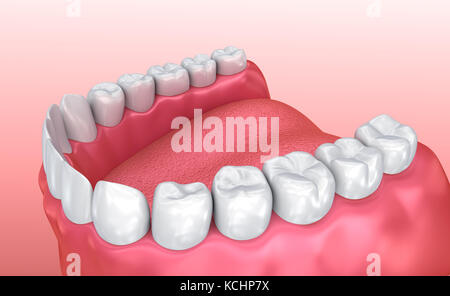 Gum bouche et des dents. Dent précise médicalement 3D illustration Banque D'Images