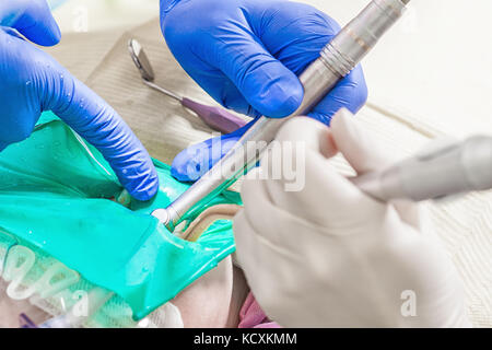 Close-up d'un dentiste en bleu gants stériles à usage unique pour les exercices d'une fraise dentaire caries Les caries d'un Banque D'Images