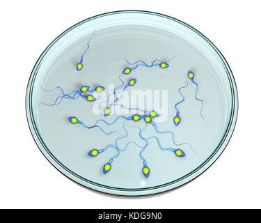 Concept de fécondation in vitro. Illustration de l'informatique spermatozoans dans une boîte de pétri en attente d'être utilisé pour féconder un ovule. Banque D'Images