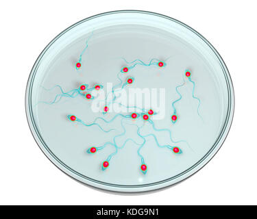 Concept de fécondation in vitro. Illustration de l'informatique spermatozoans dans une boîte de pétri en attente d'être utilisé pour féconder un ovule. Banque D'Images