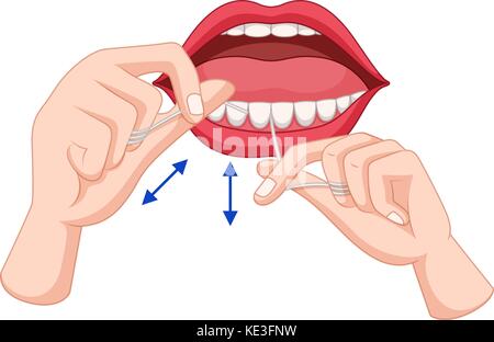 Processus d'utilisation de la soie dentaire dents illustration Illustration de Vecteur