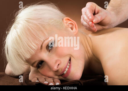 Close-up of a Young Woman Receiving Acupuncture Treatment In A Beauty Spa Banque D'Images