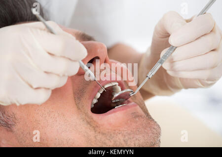 Homme mûr examiné par un dentiste en clinique Banque D'Images