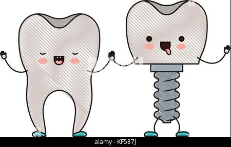 La dent et de l'implant avec la vis et tenir la main en silhouette crayon de couleur Illustration de Vecteur