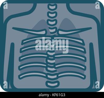 Les poumons humains xray Illustration de Vecteur