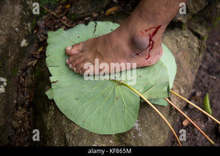 L'Indonésie, flores, flux sanguin vers le bas la jambe de notre guide lodi après avoir retiré une sangsue sur la randonnée à wae rebo village Banque D'Images