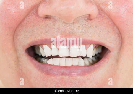 Close-up of a Senior Man montrant ses dents Banque D'Images