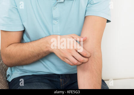 Portrait de jeune homme souffrant de démangeaisons Sitting on Sofa Banque D'Images