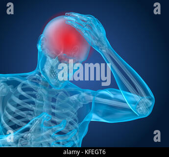 Attaque de la douleur, l'homme souffrant de douleur au cerveau. 3D illustration Banque D'Images