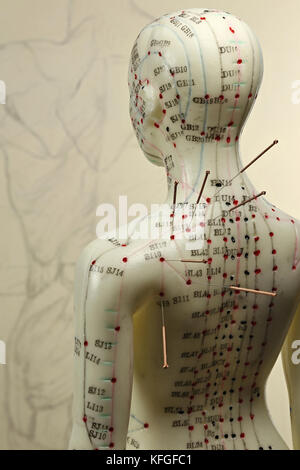 Modèle d'acupuncture femme avec des aiguilles dans l'épaule Banque D'Images