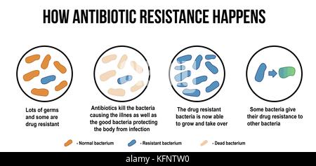 Comment la résistance aux antibiotiques se produit diagramme, illustration vectorielle (pour l'éducation médicale de base, pour les cliniques et écoles) Illustration de Vecteur