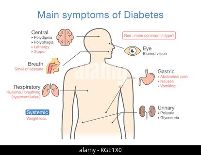 Illustration des principaux symptômes du diabète. Illustration de Vecteur