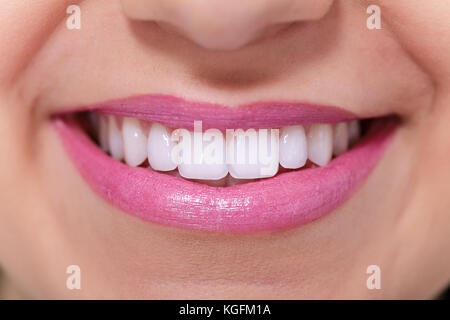 Close up of female parfaitement sain sourire dents blanches. Banque D'Images