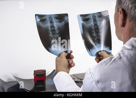 Médecin de regarder à l'x-ray film de cou et dos Banque D'Images