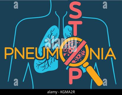 Illustration, une affiche ou une bannière de la journée mondiale de la pneumonie dans la forme de l'anatomie des poumons et les bactéries qui causent la maladie et une inscription stop. Illustration de Vecteur