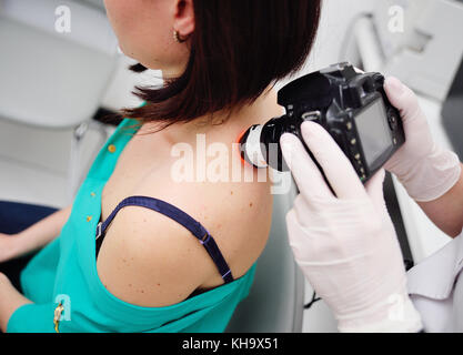 Le médecin examine le patient's mole Banque D'Images