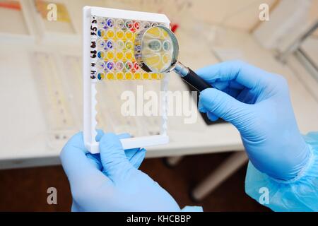 Assistant de laboratoire ou un scientifique examine à la loupe les tests bactériologiques. Banque D'Images