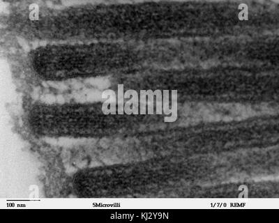 Cette image du microscope électronique à transmission (TEM) montre la structure détaillée des microvillosités dans le jéjunum humain. Ces structures microscopiques sont cruciales pour l'absorption des nutriments dans le système digestif. Banque D'Images