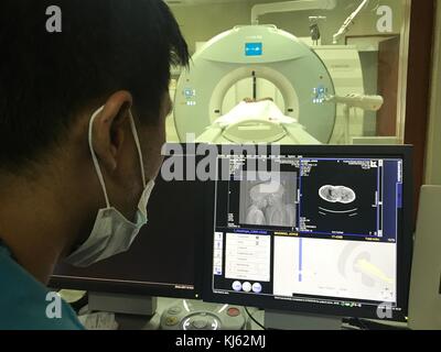 San Juan, aux Philippines. 20 nov, 2017. Joie et Joyce magsino, vieux de 10 ans sont des frères siamois en espérant que par une chirurgie qu'ils seront séparés et ont leur propre vie. Les jumeaux siamois subissant différentes procédures médicales en préparation de leur séparation. les jumeaux aimait aussi jouer à des jeux sur leur téléphone mobile. sherbien dacalanio : crédit/pacific press/Alamy live news Banque D'Images