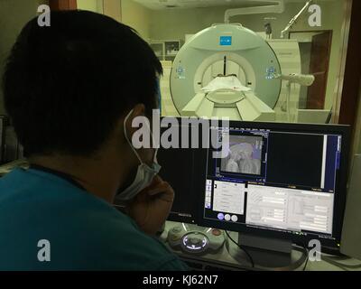 San Juan, aux Philippines. 20 nov, 2017. Joie et Joyce magsino, vieux de 10 ans sont des frères siamois en espérant que par une chirurgie qu'ils seront séparés et ont leur propre vie. Les jumeaux siamois subissant différentes procédures médicales en préparation de leur séparation. les jumeaux aimait aussi jouer à des jeux sur leur téléphone mobile. sherbien dacalanio : crédit/pacific press/Alamy live news Banque D'Images