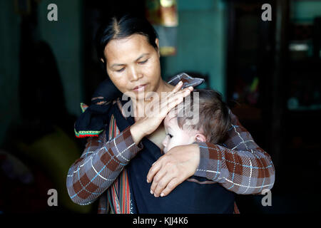 Mère et son jeune garçon atteint de la maladie de coeur. Kon Tum. Le Vietnam. Banque D'Images