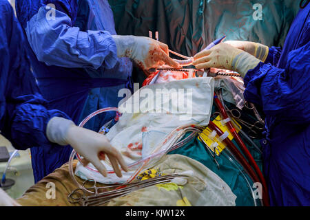 Gros plan du main du médecin dans les gants dans le sang est titulaire de la pince lors de l'opération. les soins médicaux et de concept. Banque D'Images