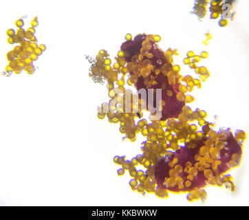 Microphotograph, fleur pollen sur 40x fois, Portulaca grandiflora et rosa l. le pollen, par microscope Banque D'Images