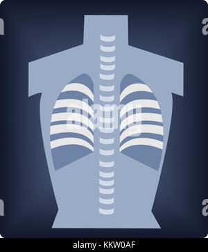 Illustration d'une radiographie ray Banque D'Images