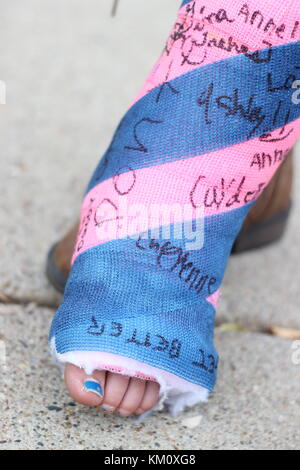 Close up detail de signé moulé sur les petites filles de la jambe ou pied en rose et bleu Banque D'Images