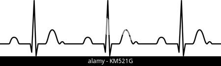 Électrocardiogramme (normal) , coeur noir , ECG de rythme d'illustration vectorielle, isolé. Illustration de Vecteur