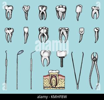 L'émail des dents molaires, ensemble de soins dentaires de l'équipement. instruments médecin dentiste. cavité orale nettoyer ou malades. la santé ou des caries. gravés à la main dans de vieux ou croquis. médecine, soins pour l'implant, l'empreinte Illustration de Vecteur