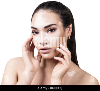 Portrait de belle femme avec vitiligo. Banque D'Images