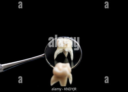 Mauvaise dent pourrie est sorti et est situé en face du miroir dentaire sur une base isolée noir Banque D'Images