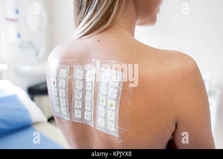 Patient en cours d'un test cutané dans l'allergie clinique. Banque D'Images