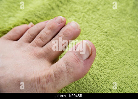Les ongles sales sur l'homme pieds sur serviette verte Banque D'Images